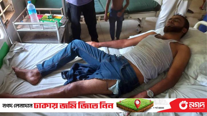Terrorists broke journalist's leg in Pabna