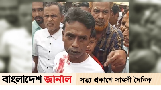 Handicapped pedestrian injured by police baton