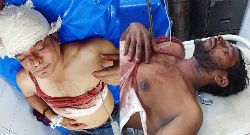 UP Chairman shot and hacked in Barisal's Gournadi
