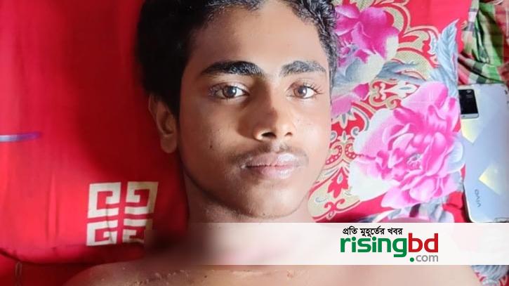 He was shot dead and lying on the street, free, meaning treatment was off