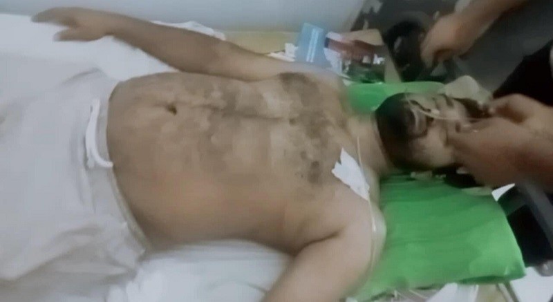 Three youths injured in Lohagara firing by miscreants