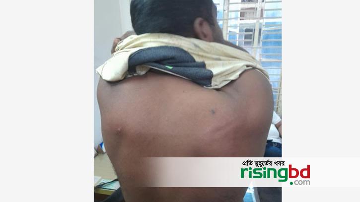 Allegation of attack on journalist in Jessore