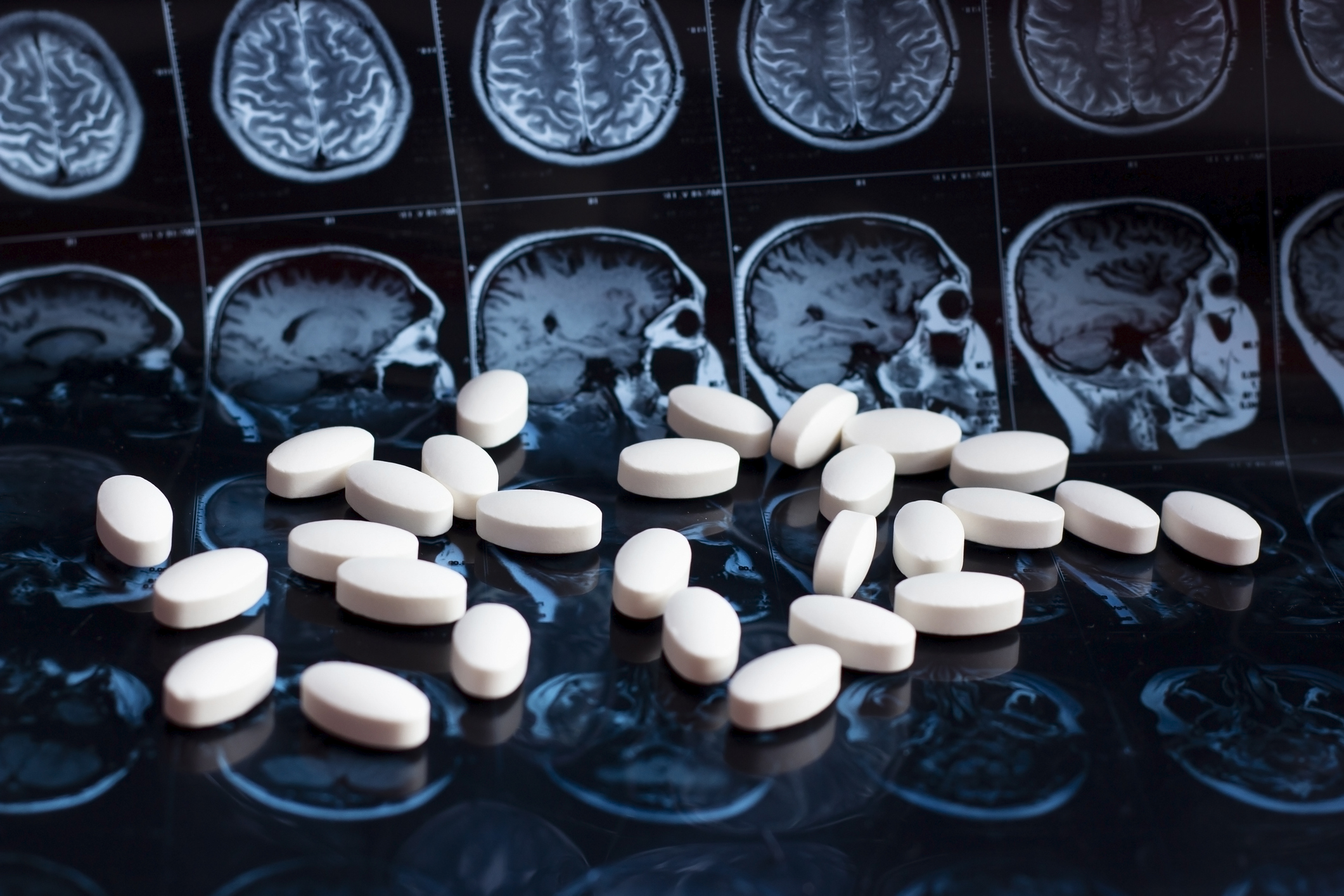 Cancer Drug May Reverse Alzheimer’s Disease