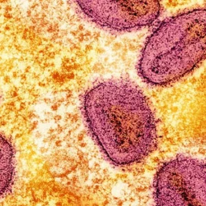 This time, empox was detected in Thailand