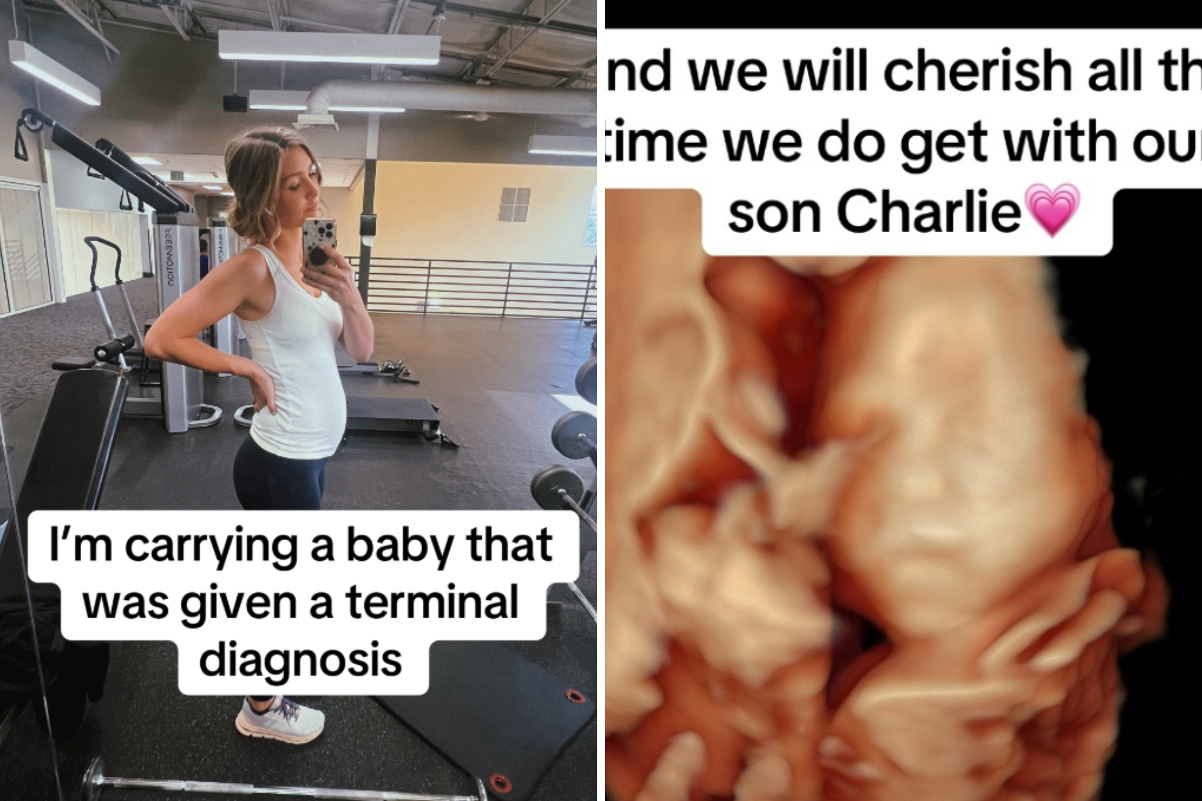 Heartbreak for Mom Carrying Baby Boy With Terminal Illness