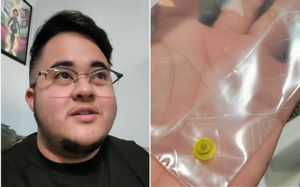 Sneeze in the Shower Reveals What’s Been Stuck Up Nose for 25 Years