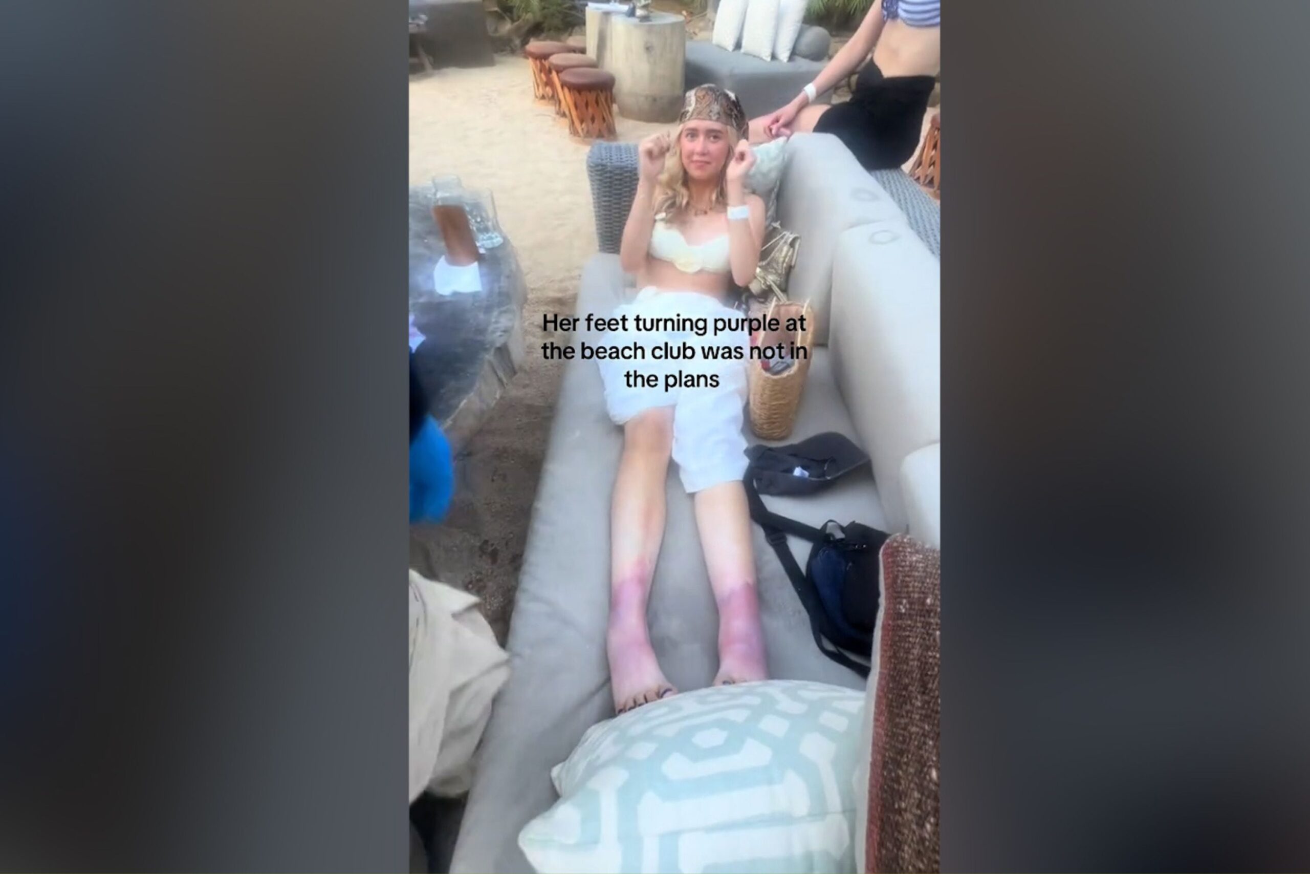 American Woman’s Feet Mysteriously Turn Purple on Vacation in Mexico